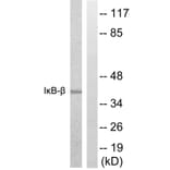 Western Blot - Anti-IkappaB-beta Antibody (B0438) - Antibodies.com