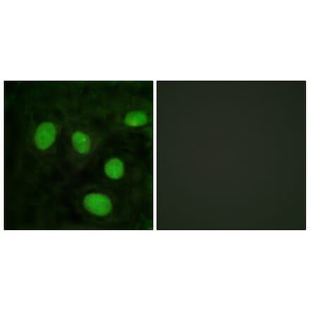 Immunofluorescence - Anti-Histone H1oo Antibody (D0021) - Antibodies.com