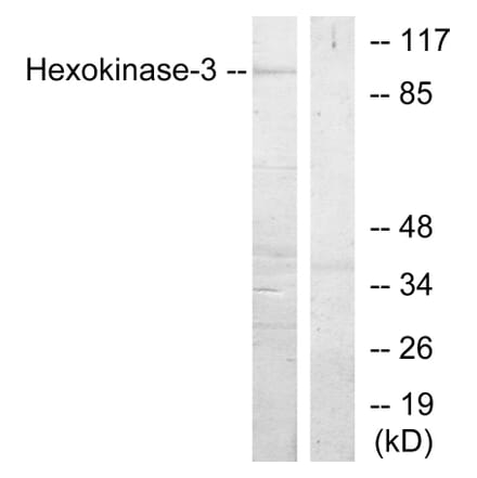 Western Blot - Anti-Hexokinase-3 Antibody (C10708) - Antibodies.com