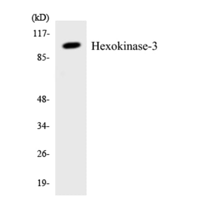 Western Blot - Anti-Hexokinase-3 Antibody (R12-2876) - Antibodies.com