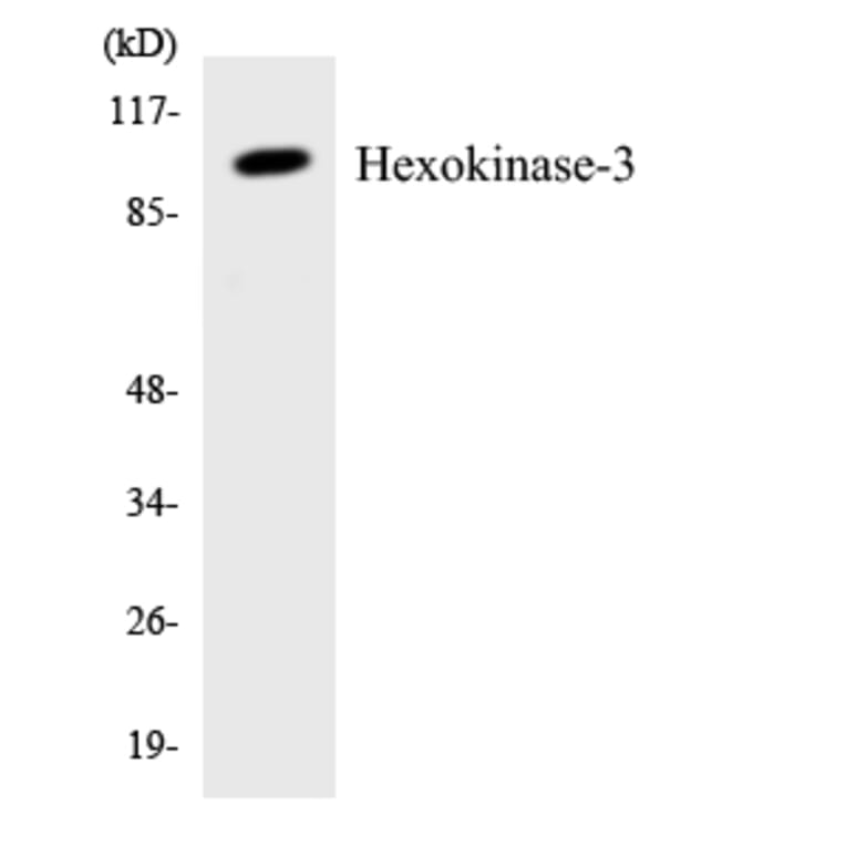 Western Blot - Anti-Hexokinase-3 Antibody (R12-2876) - Antibodies.com