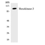 Western Blot - Anti-Hexokinase-3 Antibody (R12-2876) - Antibodies.com