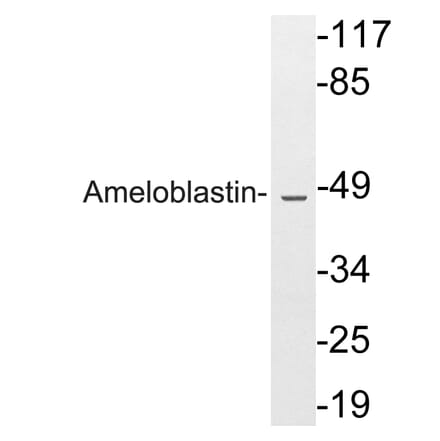 Western Blot - Anti-Ameloblastin Antibody (R12-2020) - Antibodies.com