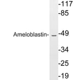 Western Blot - Anti-Ameloblastin Antibody (R12-2020) - Antibodies.com
