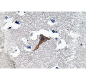 Immunohistochemistry - Anti-Cathepsin H Antibody (R12-2061) - Antibodies.com