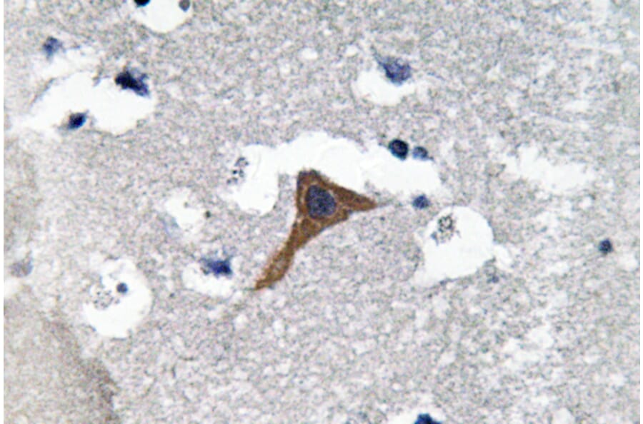 Immunohistochemistry - Anti-Cathepsin H Antibody (R12-2061) - Antibodies.com