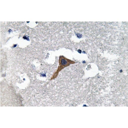 Immunohistochemistry - Anti-Cathepsin H Antibody (R12-2061) - Antibodies.com