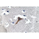 Immunohistochemistry - Anti-Cathepsin H Antibody (R12-2061) - Antibodies.com
