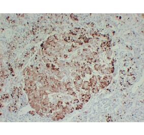 Immunohistochemistry - Anti-Prolactin Antibody (V0115) - Antibodies.com