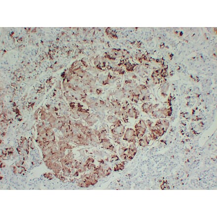 Immunohistochemistry - Anti-Prolactin Antibody (V0115) - Antibodies.com
