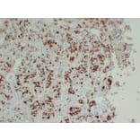 Immunohistochemistry - Anti-Prolactin Antibody (V0115) - Antibodies.com