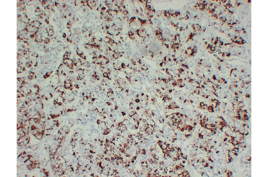 Immunohistochemistry - Anti-Prolactin Antibody (V0115) - Antibodies.com