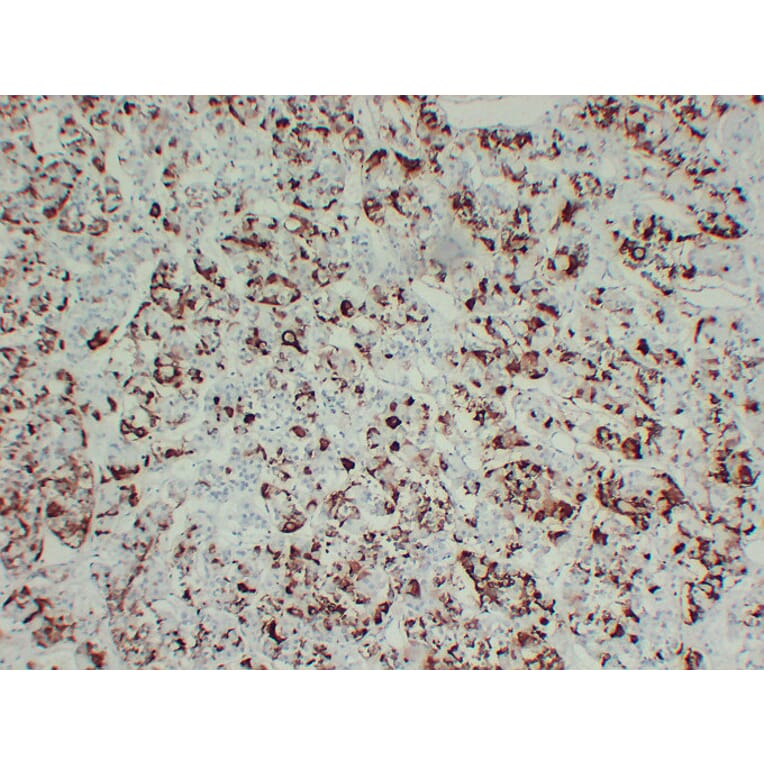 Immunohistochemistry - Anti-Prolactin Antibody (V0115) - Antibodies.com
