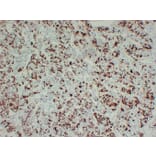 Immunohistochemistry - Anti-Prolactin Antibody (V0115) - Antibodies.com