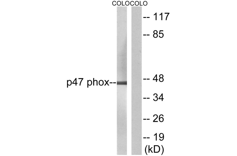 Western Blot - Anti-p47 phox Antibody (B1160) - Antibodies.com