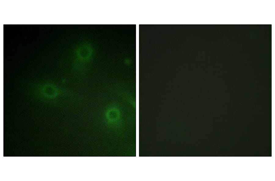 Immunofluorescence - Anti-p47 phox Antibody (B1160) - Antibodies.com