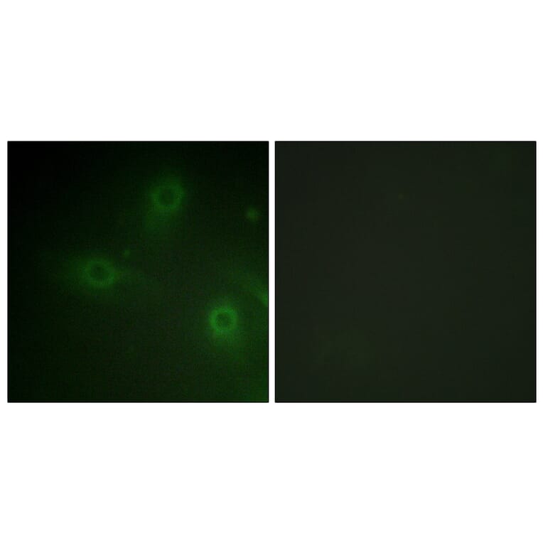 Immunofluorescence - Anti-p47 phox Antibody (B1160) - Antibodies.com