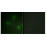 Immunofluorescence - Anti-p47 phox Antibody (B1160) - Antibodies.com