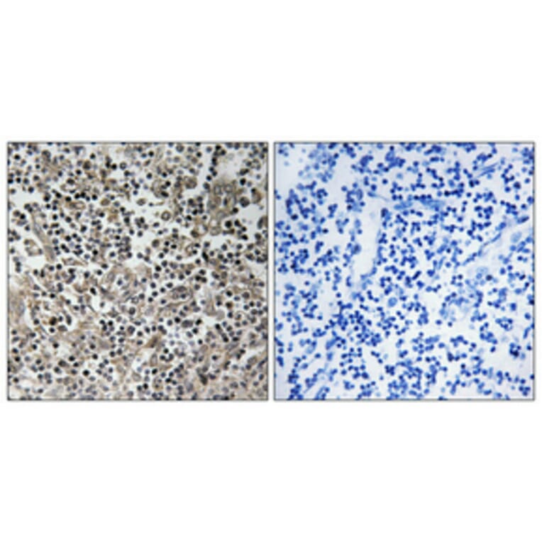 Immunohistochemistry - Anti-p47 phox Antibody (B1160) - Antibodies.com