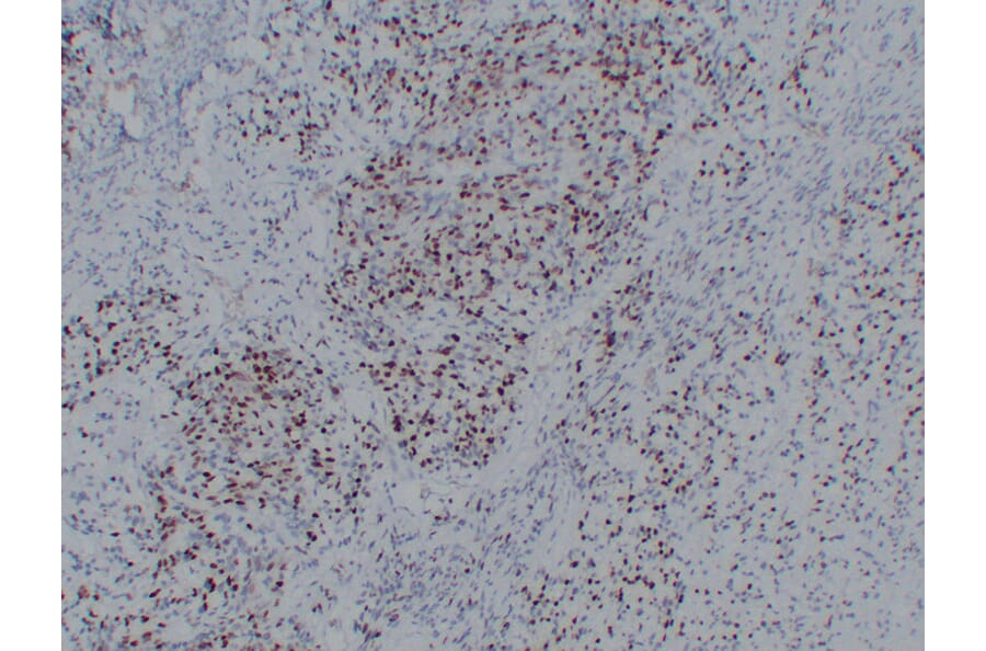 Immunohistochemistry - Anti-Myogenin Antibody (V0101) - Antibodies.com