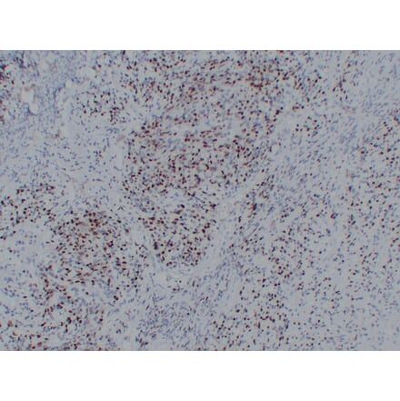 Immunohistochemistry - Anti-Myogenin Antibody (V0101) - Antibodies.com