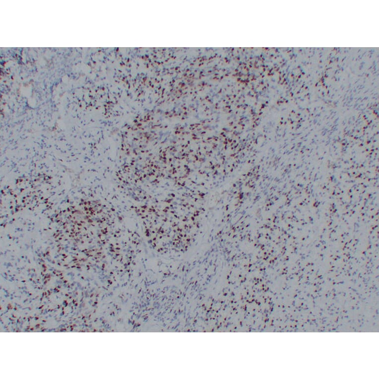 Immunohistochemistry - Anti-Myogenin Antibody (V0101) - Antibodies.com