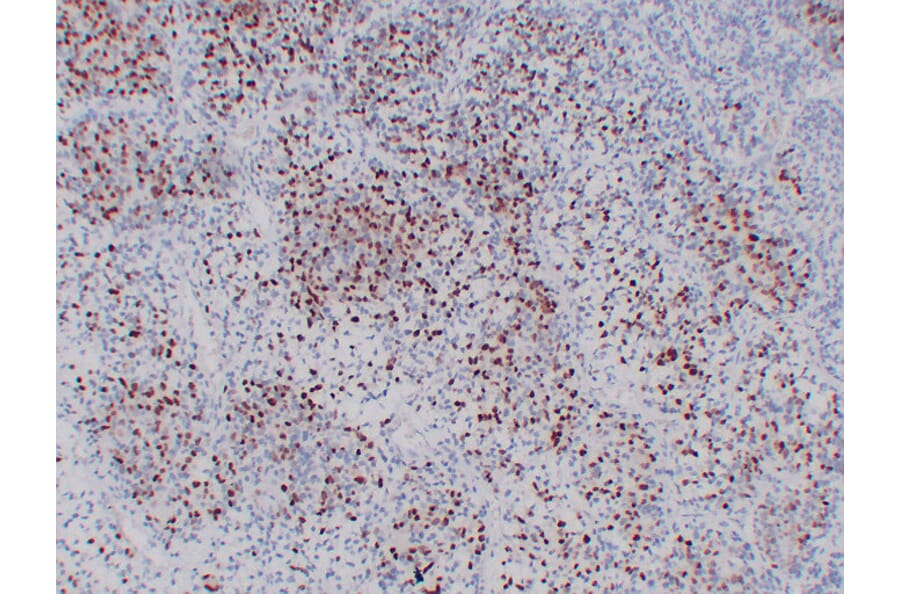 Immunohistochemistry - Anti-Myogenin Antibody (V0101) - Antibodies.com