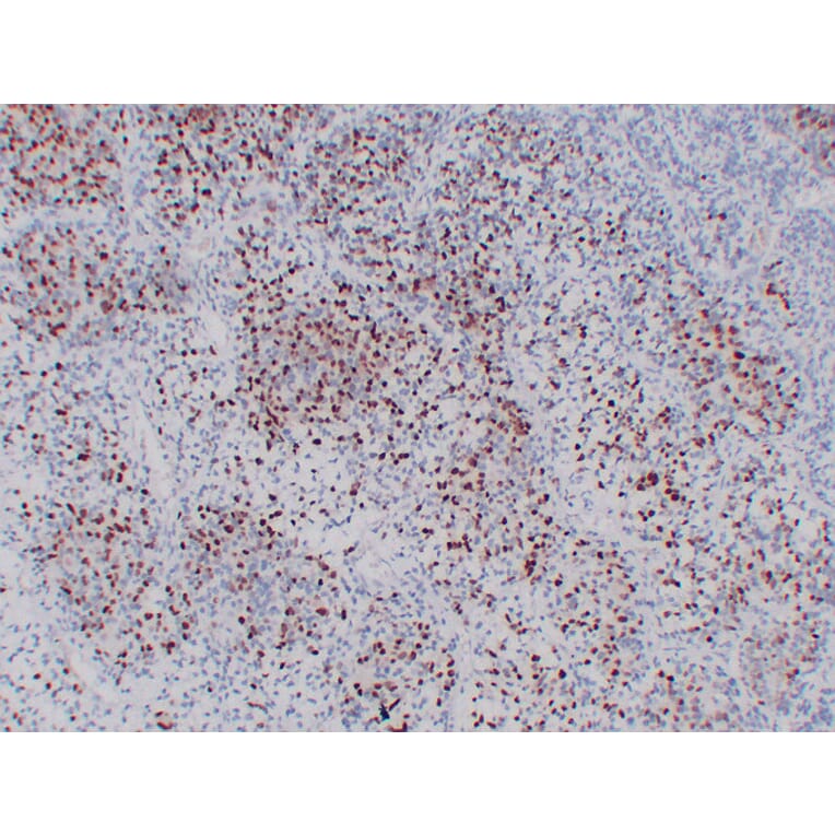 Immunohistochemistry - Anti-Myogenin Antibody (V0101) - Antibodies.com