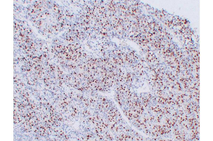 Immunohistochemistry - Anti-Myogenin Antibody (V0101) - Antibodies.com