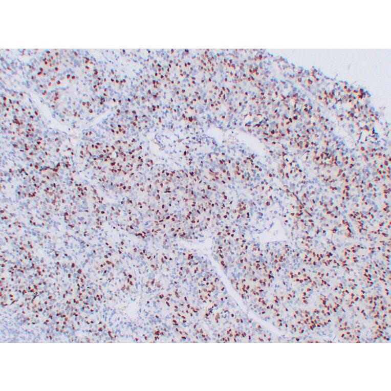 Immunohistochemistry - Anti-Myogenin Antibody (V0101) - Antibodies.com