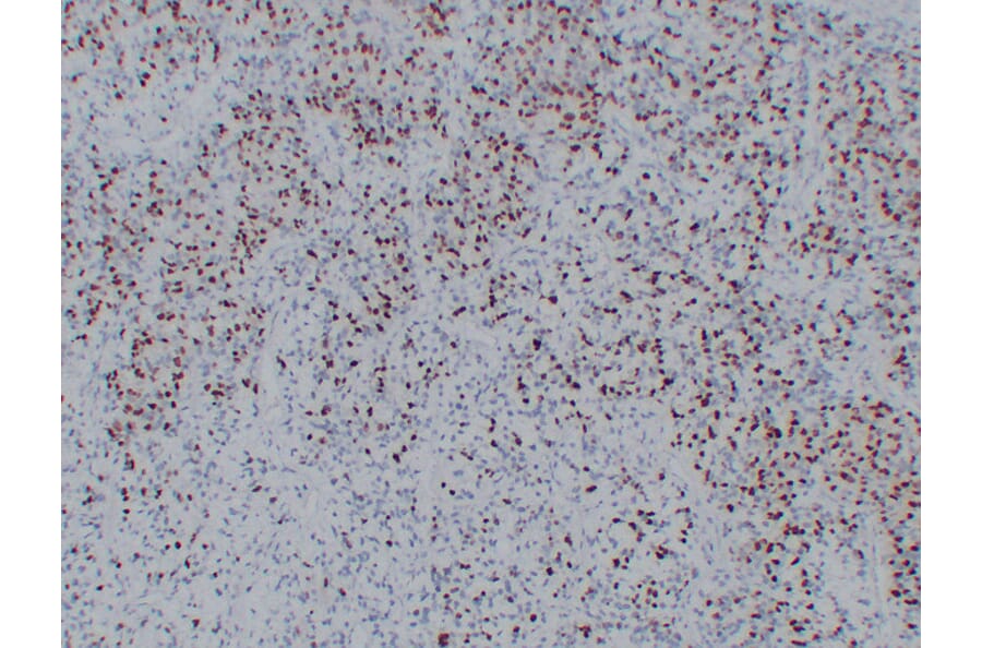 Immunohistochemistry - Anti-Myogenin Antibody (V0101) - Antibodies.com