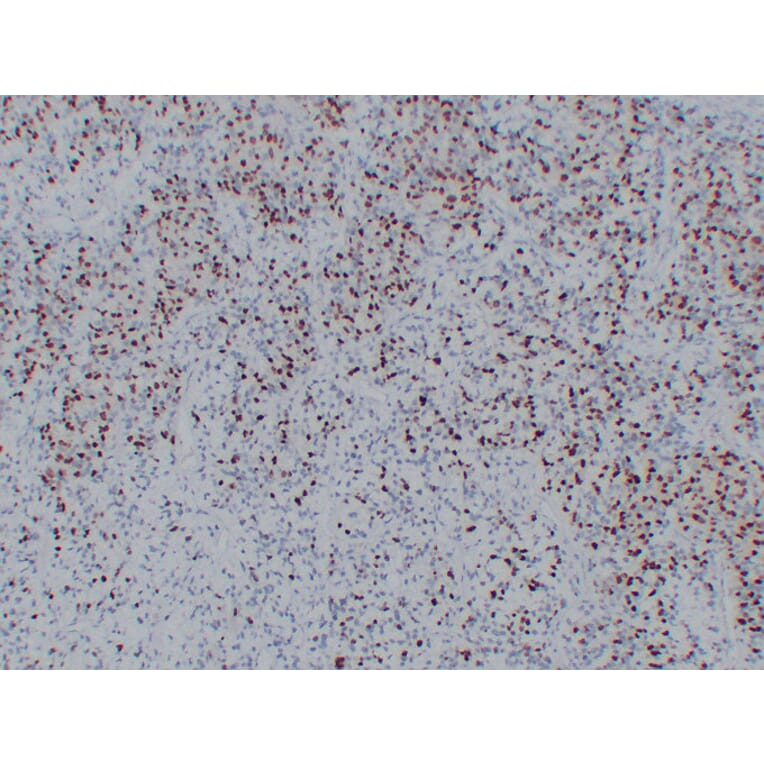 Immunohistochemistry - Anti-Myogenin Antibody (V0101) - Antibodies.com