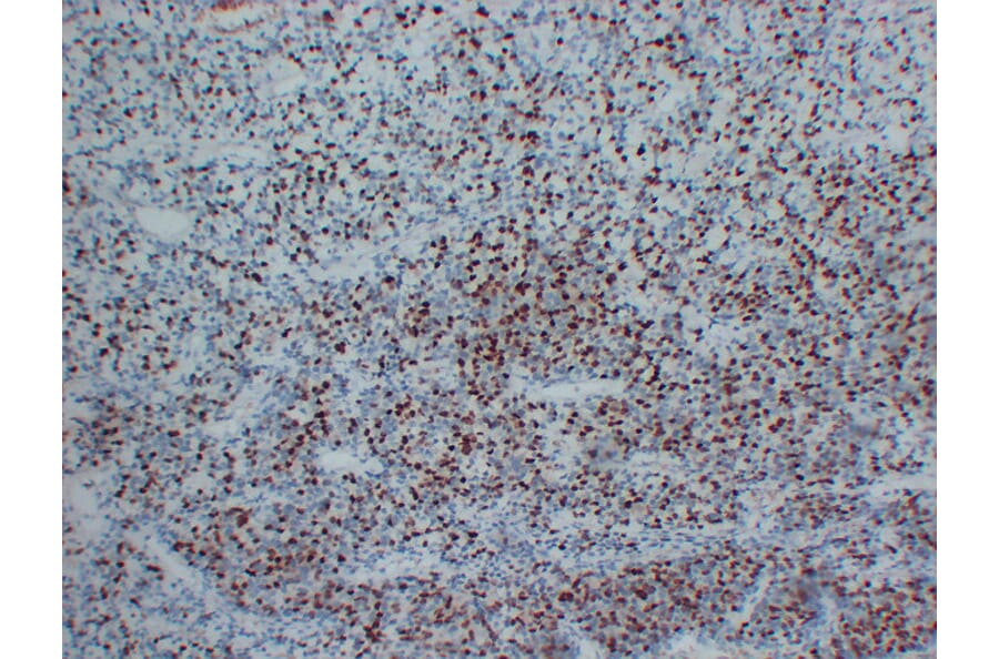 Immunohistochemistry - Anti-Myogenin Antibody (V0101) - Antibodies.com