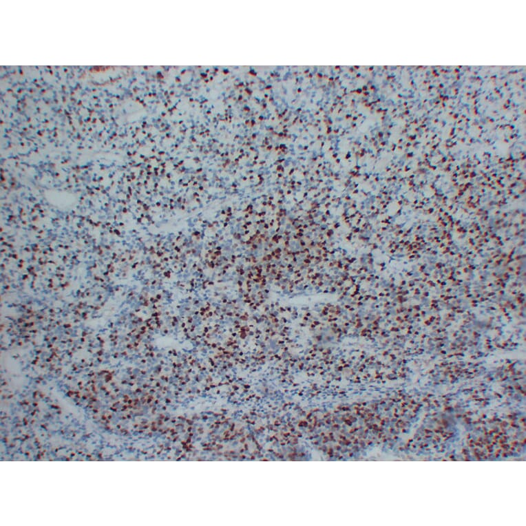 Immunohistochemistry - Anti-Myogenin Antibody (V0101) - Antibodies.com