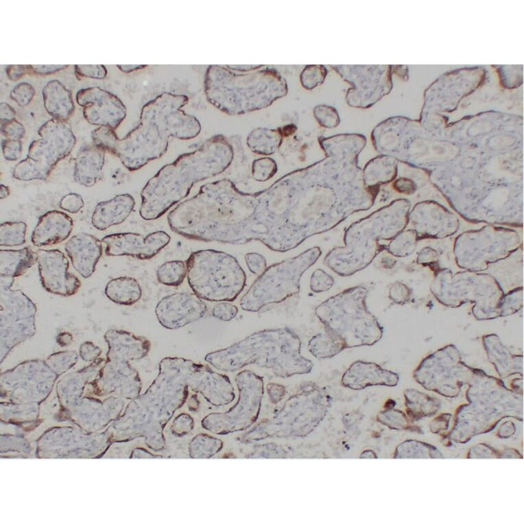 Immunohistochemistry - Anti-hCG beta Antibody (V0081) - Antibodies.com