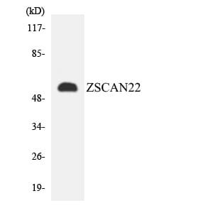 Western blot analysis of the lysates from HepG2 cells using Anti-ZSCAN22 Antibody.