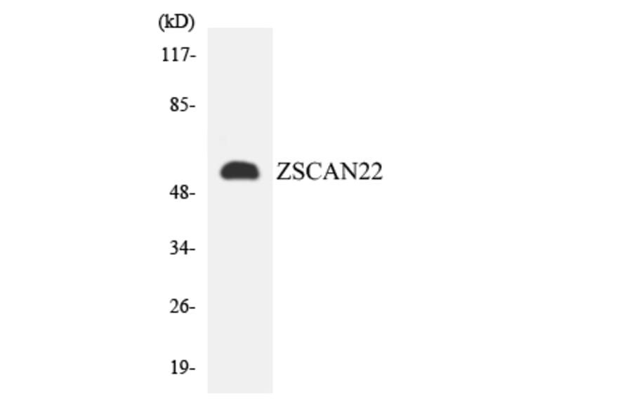 Western Blot - Anti-ZSCAN22 Antibody (R12-3707) - Antibodies.com