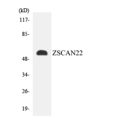 Western Blot - Anti-ZSCAN22 Antibody (R12-3707) - Antibodies.com