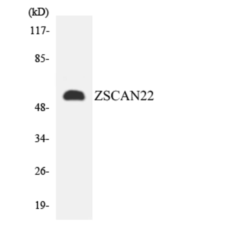 Western Blot - Anti-ZSCAN22 Antibody (R12-3707) - Antibodies.com