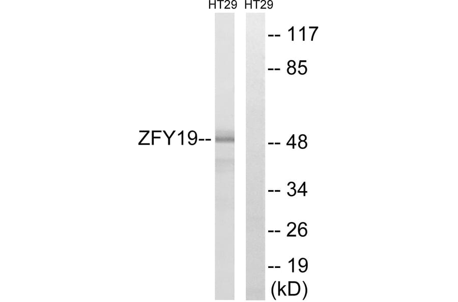 Western Blot - Anti-ZFYVE19 Antibody (C19582) - Antibodies.com