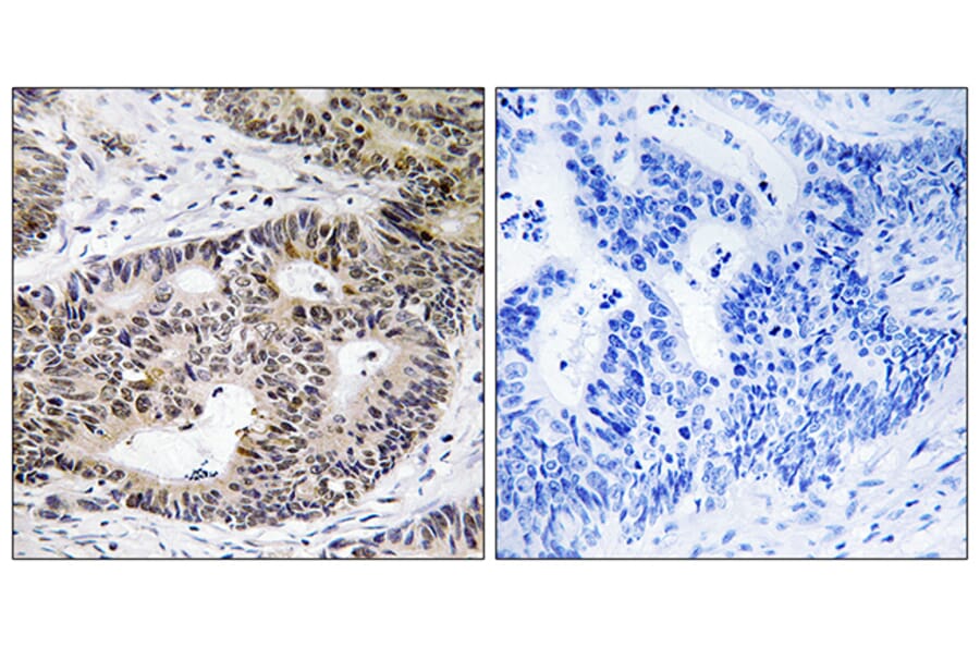 Immunohistochemistry - Anti-ZFYVE19 Antibody (C19582) - Antibodies.com