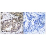 Immunohistochemistry - Anti-ZFYVE19 Antibody (C19582) - Antibodies.com