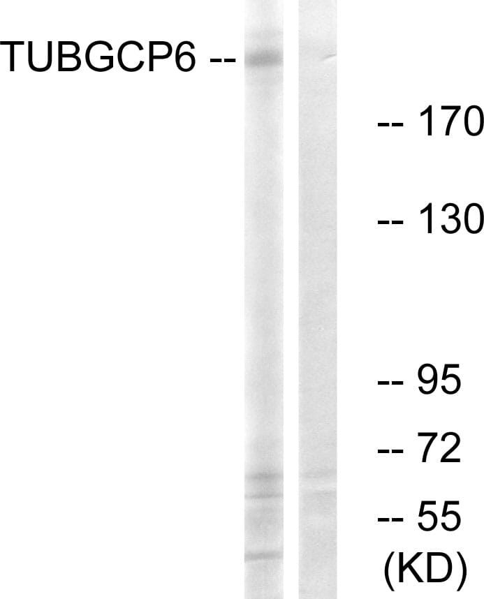 Western blot analysis of lysates from COLO cells using Anti-TUBGCP6 Antibody. The right hand lane represents a negative control, where the antibody is blocked by the immunising peptide.