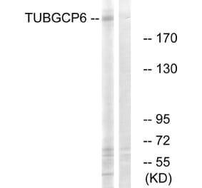 Western Blot - Anti-TUBGCP6 Antibody (C15874) - Antibodies.com