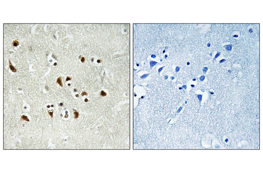 Immunohistochemistry - Anti-TUBGCP6 Antibody (C15874) - Antibodies.com