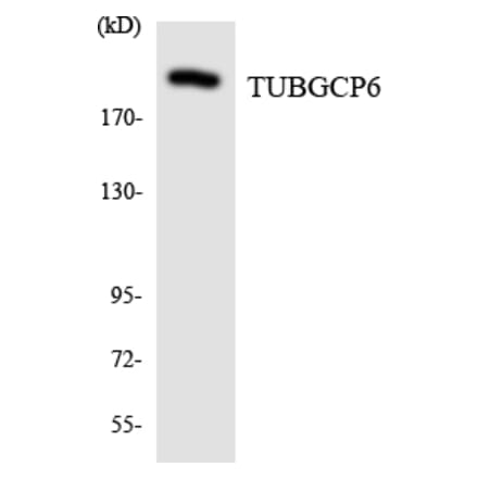 Western Blot - Anti-TUBGCP6 Antibody (R12-3659) - Antibodies.com