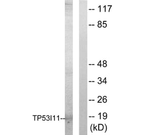 Western Blot - Anti-TP53I11 Antibody (C10041) - Antibodies.com