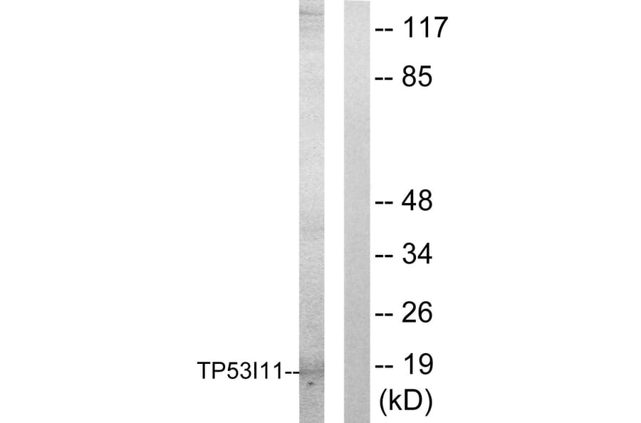 Western Blot - Anti-TP53I11 Antibody (C10041) - Antibodies.com