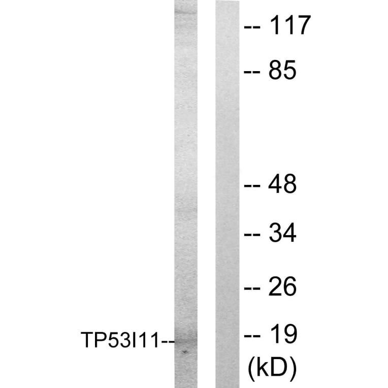 Western Blot - Anti-TP53I11 Antibody (C10041) - Antibodies.com