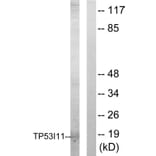 Western Blot - Anti-TP53I11 Antibody (C10041) - Antibodies.com